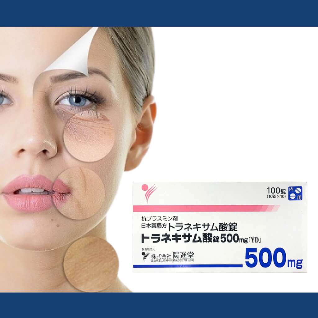 Viên Uống Hỗ Trợ Trị Nám Trắng Da Transamin 7 Viên Uống Hỗ Trợ Trị Nám Trắng Da Transamin